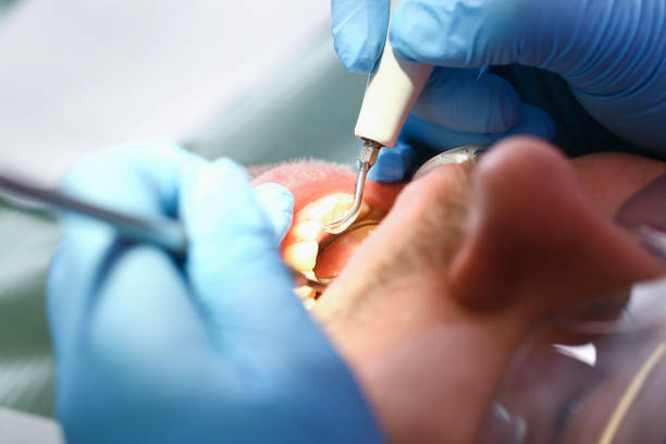Best Emergency Broken Tooth Repair in Monroeville, AL