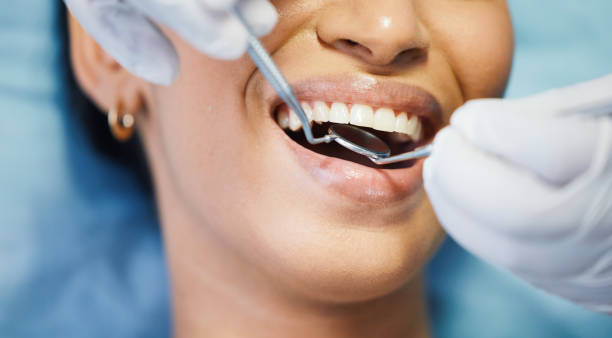Best Same-Day Emergency Dentist in Monroeville, AL
